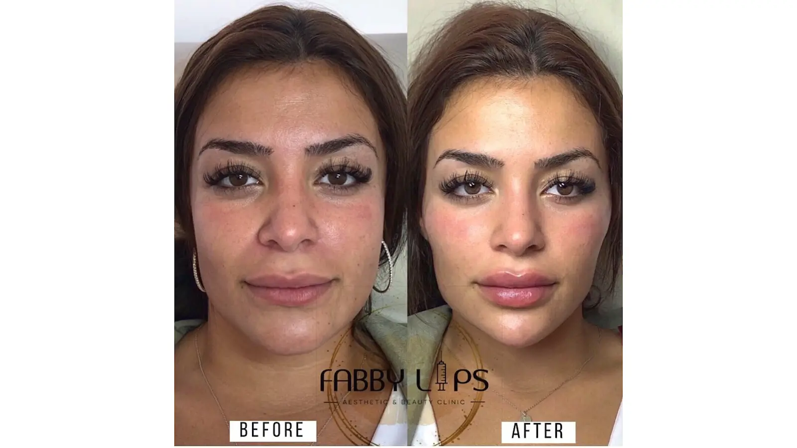 Split image showing a person's face before and after beauty treatment. The left side is labeled "Before" and shows a natural look, while the right side, labeled "After," highlights enhanced features.