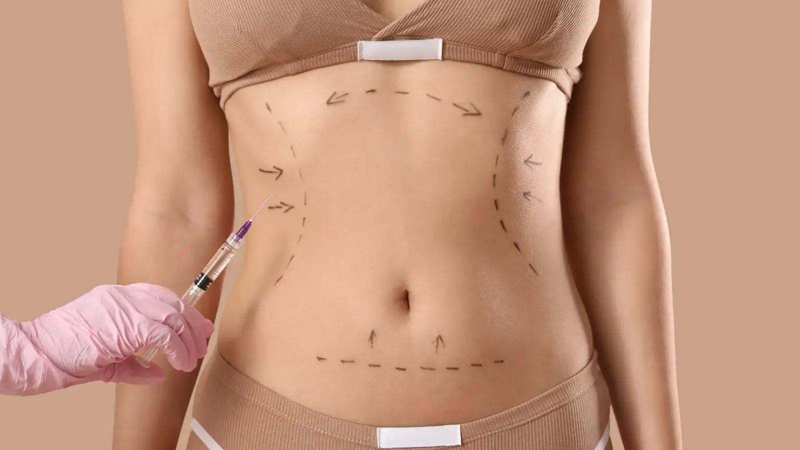 A woman in a brown two-piece outfit has dashed lines and arrows drawn on her abdomen, indicating potential areas for cosmetic treatment. A gloved hand holds a syringe near her stomach on a neutral background.