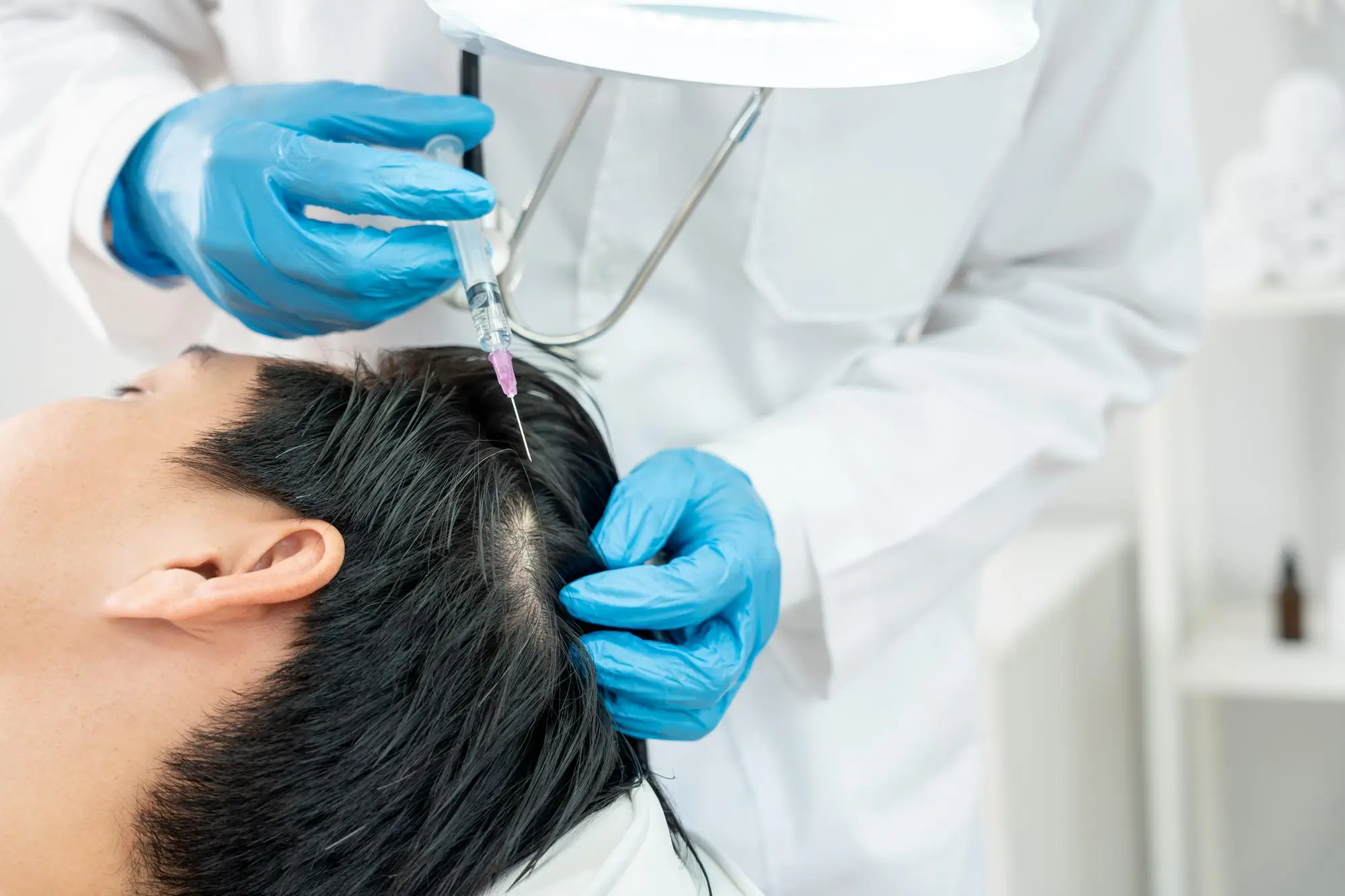 A person receiving a hair treatment injection in the scalp while reclining. A professional, wearing blue gloves and a white coat, administers the injection. The setting appears to be a clinic or healthcare facility.