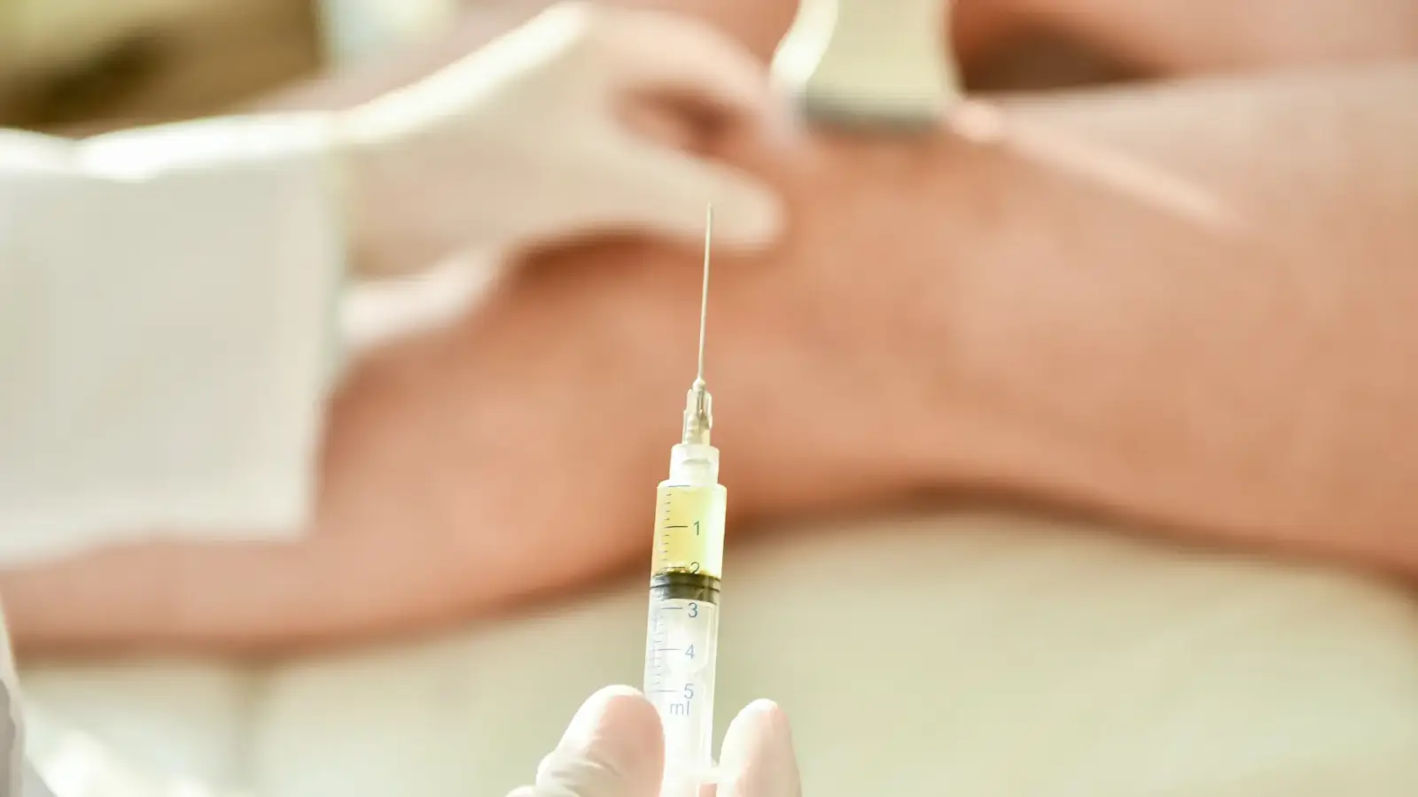 Close-up of a syringe held by a gloved hand, with a blurred background showing a person receiving a medical procedure on their leg. The focus is on the needle and the syringe filled with liquid.