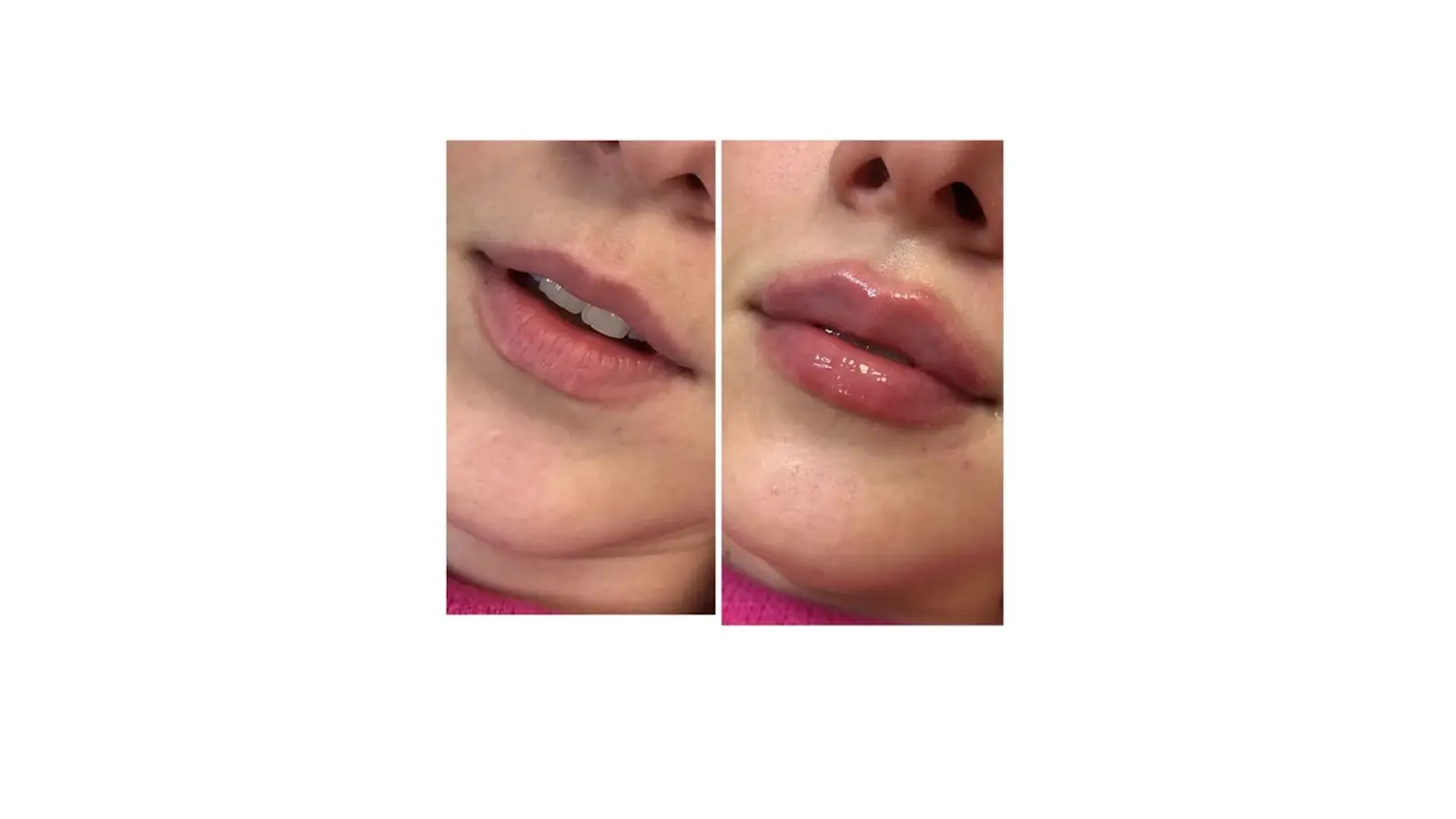 Side-by-side comparison of lips before and after a gloss application. The left image shows natural lips with a matte finish, while the right image shows the same lips with a shiny, fuller appearance due to the gloss.