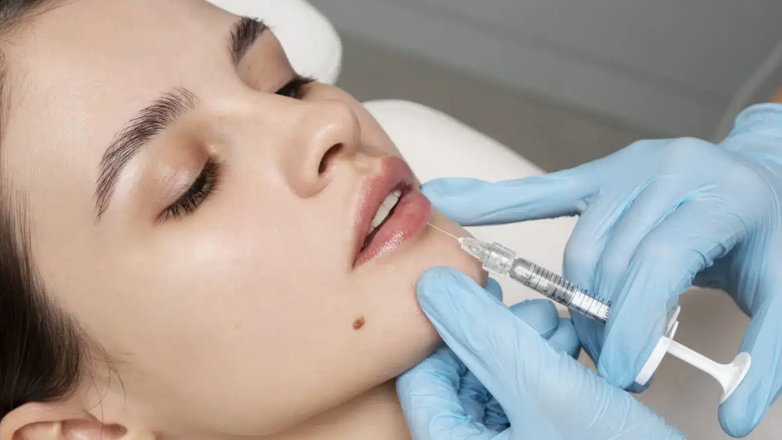 A person with closed eyes receives a cosmetic injection to the lips. Blue-gloved hands hold a syringe near the mouth. 