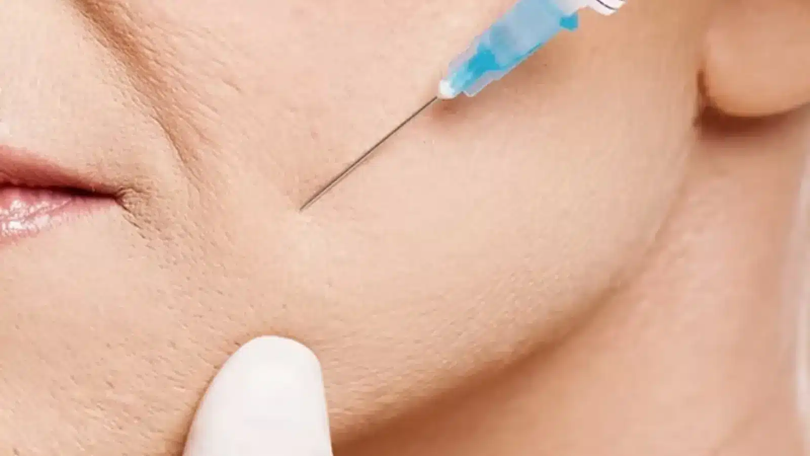 Woman getting a facial injection. 