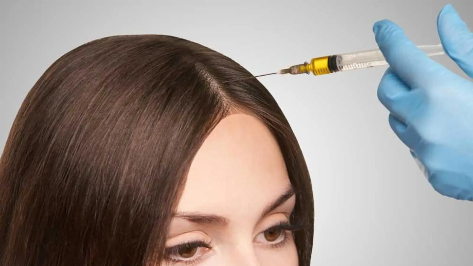 A close-up of a person's head receiving a syringe injection in their scalp by a gloved hand, possibly for a cosmetic or medical treatment.