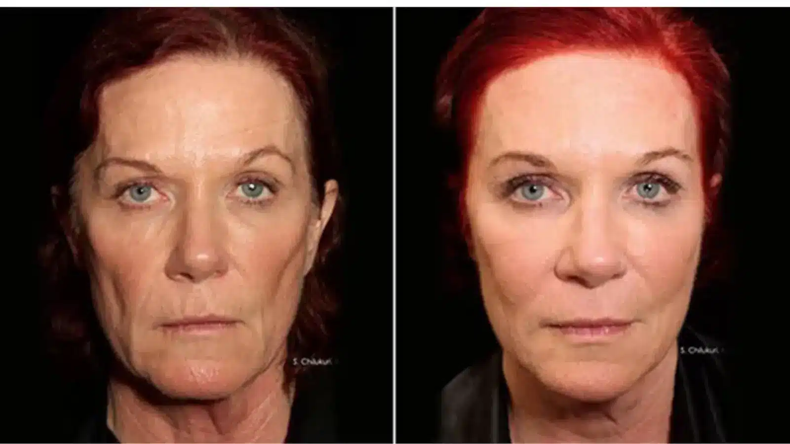 Side-by-side comparison of the same woman; left image shows her with natural red hair and visible signs of aging, while right image shows her with vibrant red hair, smoother skin, and reduced signs of aging.