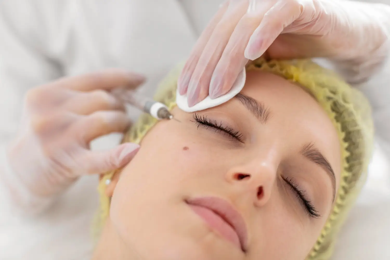 A person wearing a hairnet and lying down is receiving a cosmetic injection near the corner of their eye. A medical professional wearing gloves holds a syringe and a cotton pad, gently pressing on the person's skin.