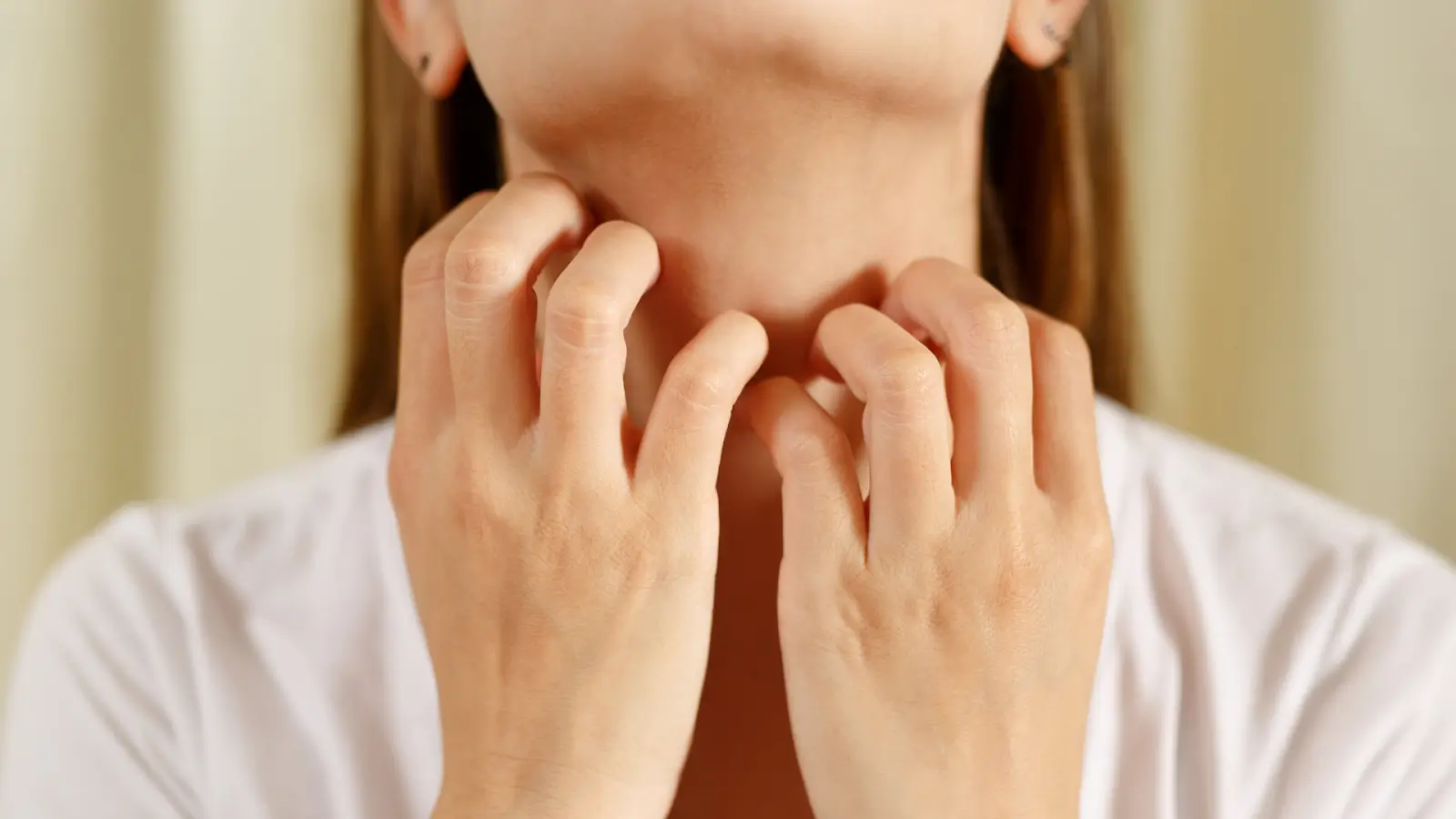 A person wearing a white shirt is scratching their neck after experiencing an allergic reaction.