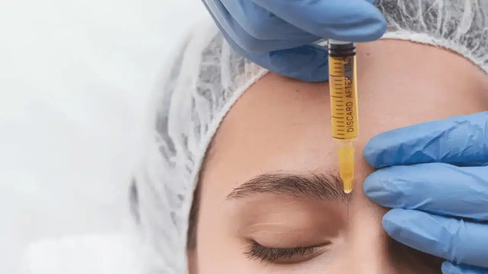 A close-up of a person with closed eyes receiving a forehead injection. 