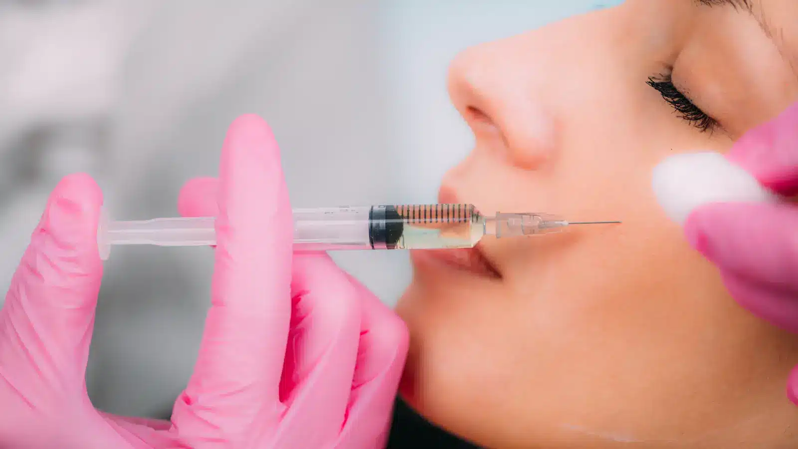 A person receiving a cosmetic injection near the lips. A syringe containing a clear liquid is held by hands wearing pink gloves. 